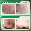 1000240618.webp
