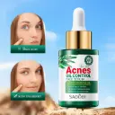 TEA TREE ACNES OIL CONTROL FACE SERUM (SADOER)